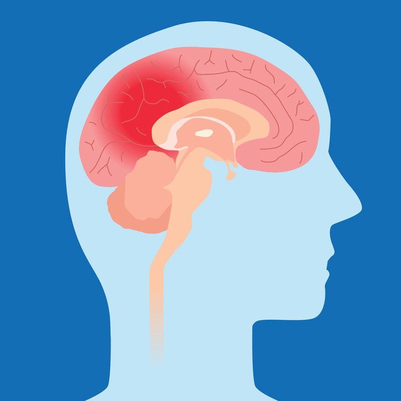 Introducing SEMI's Concussion Program!